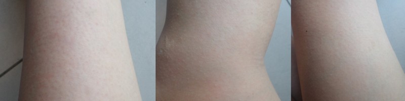 Ankle, knee and thigh - all clear.