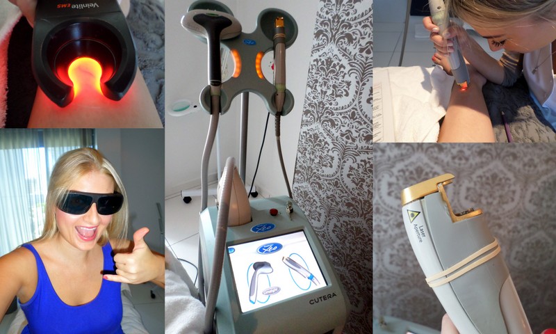 Rockin' protective eyewear and sooo excited to get my veins zapped, yo! See that rad Veinlite? Run it over your legs and they look like road maps. It helps your therapist see exactly where to place her laser.