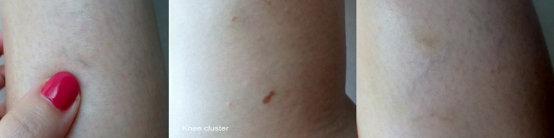 Ankle, knee and thigh.