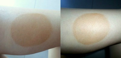 I'm still walking around with a big dot on my calf. Don't say I don't take one for the team.