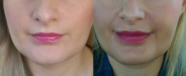 Before and after. You'll see the effect is noticeable but not over the top.