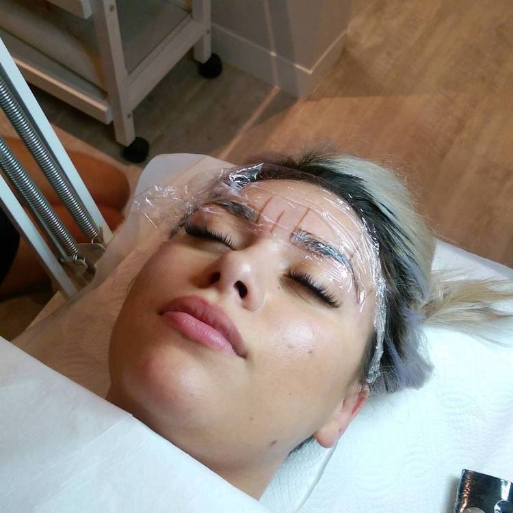 Athena, the evening's brave model, all mapped out and getting her anaesthetic on.